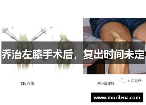 乔治左膝手术后，复出时间未定